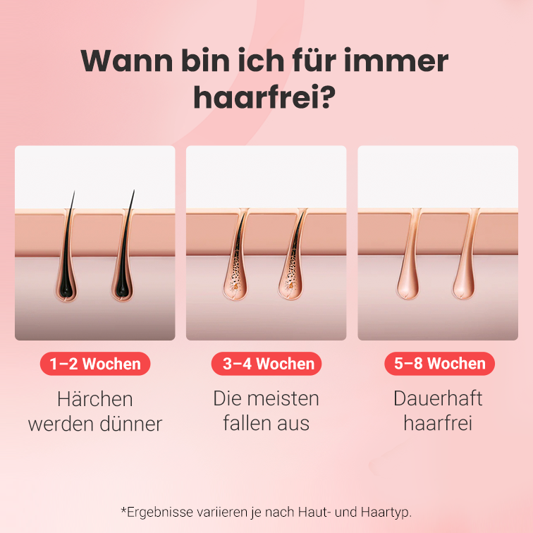 Hilda IPL-Haarentferner