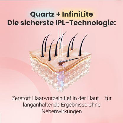 Hilda IPL-Haarentferner